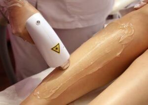 Why Do So Many Laser Hair Removal Results Fall Short of Expectations?